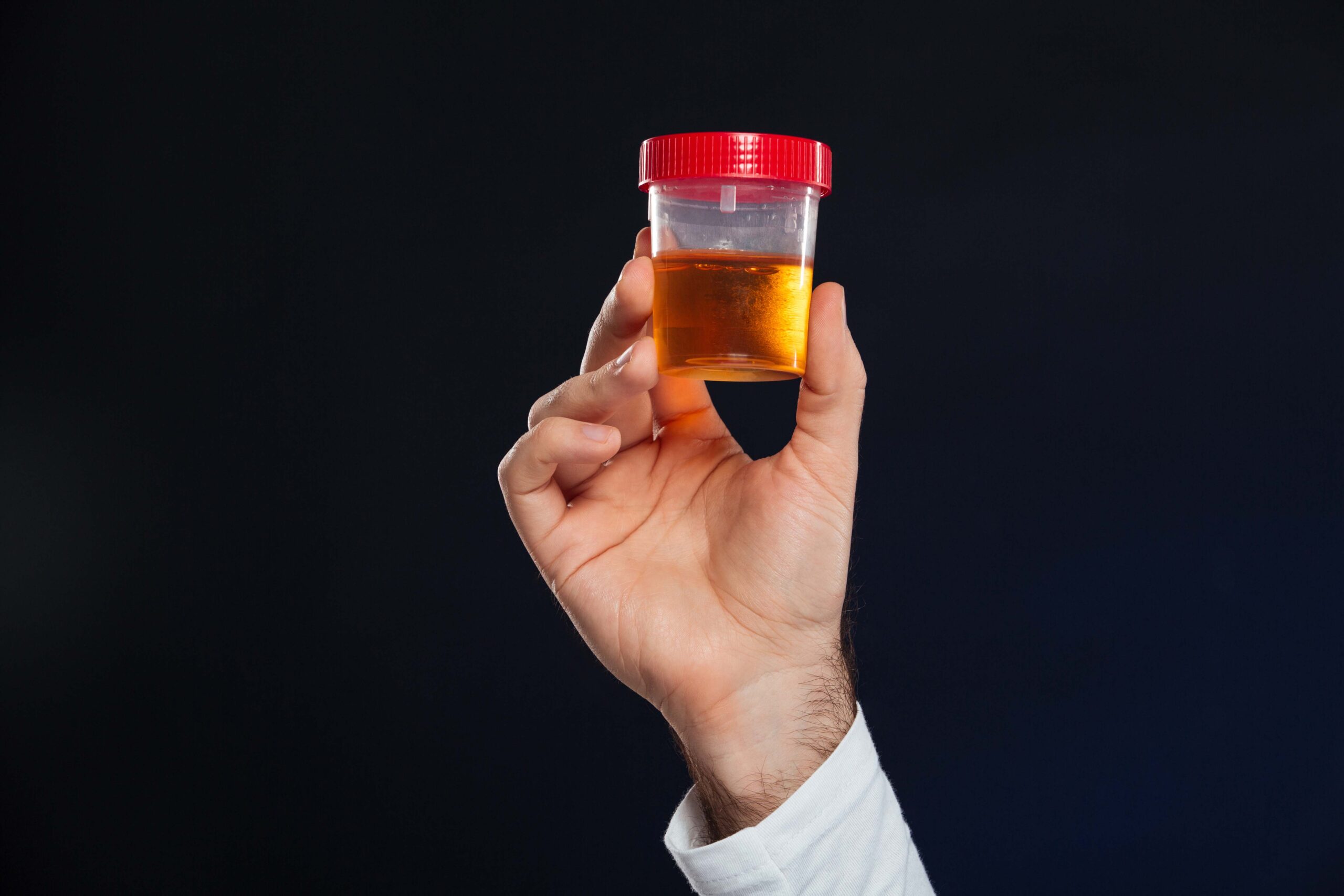 sistemas para eliminar el alcohol | cuanto dura el alcohol en la orina